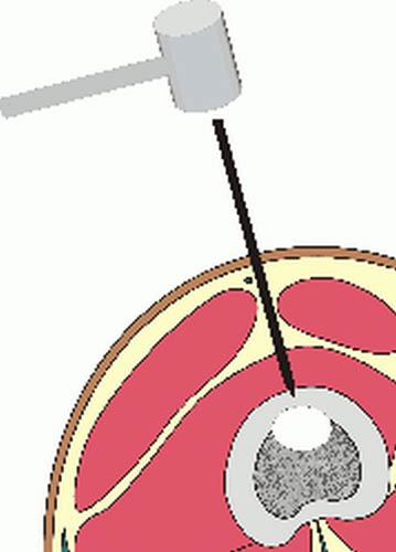 Bone puncture route