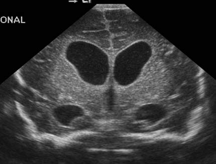 Imagen por ultrasonido de un cerebro