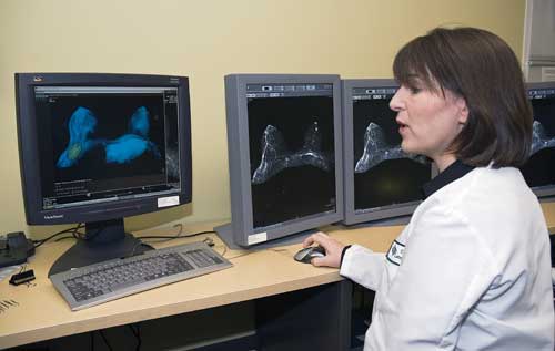 Foto de un radióloga viendo una resonancia magnética de mama en una pantalla de computadora