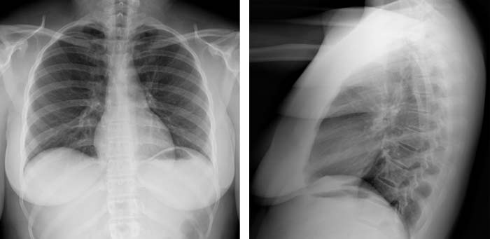 Imágenes de rayos X del tórax