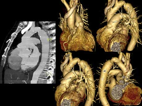 Interventional radiology images