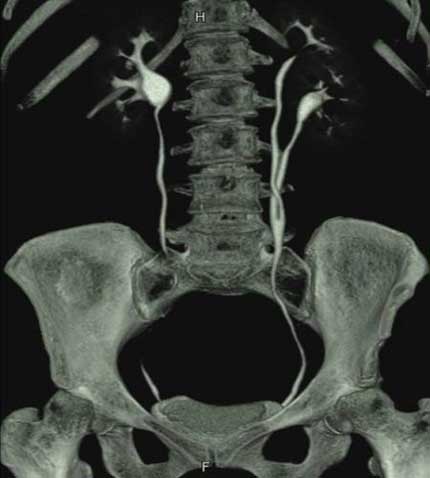 CT urogram 