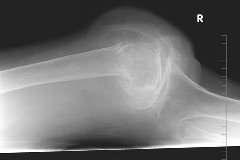 X-ray image of a patient's knee.