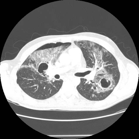 A chest CT image.