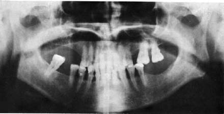Radiografía de dientes y estructuras circundantes.