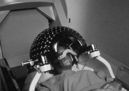 Patient in Gamma Knife Unit showing Collimator Helmet that defines the 201 treatment beams.