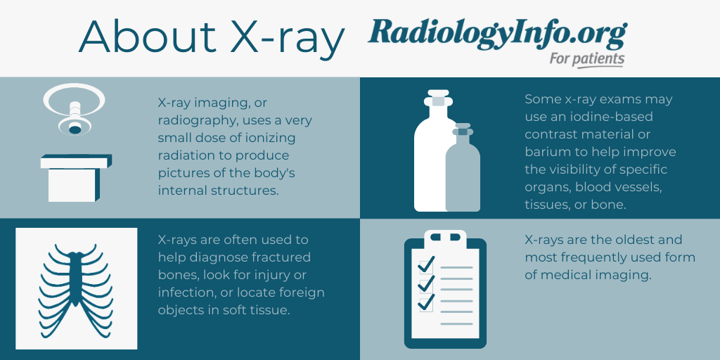 Infographic: About X-ray