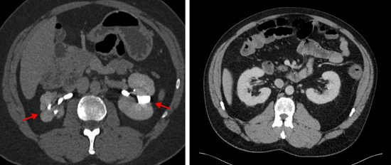 CT images of the kidneys.