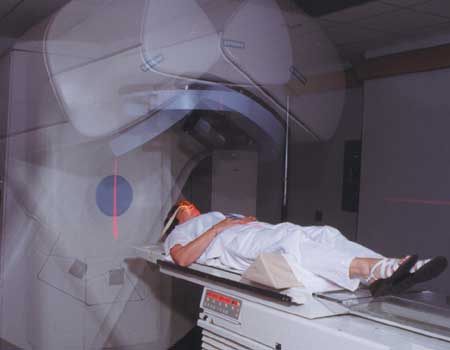 Patient undergoing radiation therapy using a linear accelerator LINAC