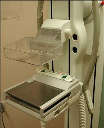 Photo of mammography equipment
