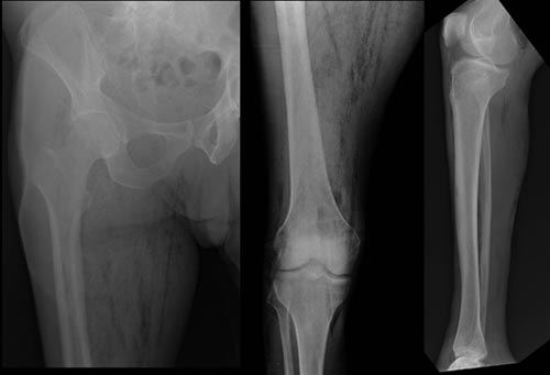 X-ray image of the right lower extremity 
