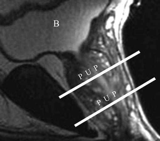 MRI image of the male pelvis