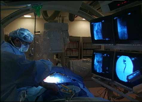 An interventional radiologist performs a catheter embolization