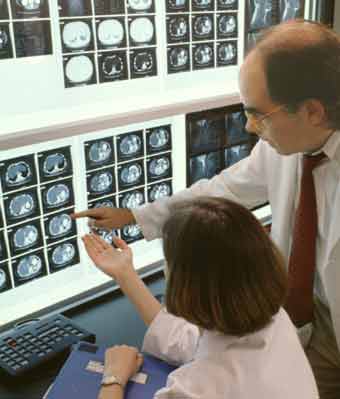 Photo of radiologists looking at a series of CT images
