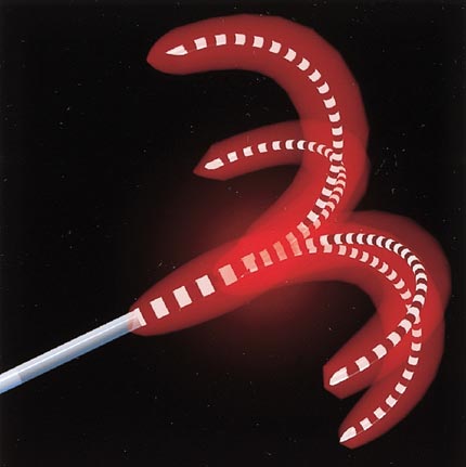 RFA - needle electrode