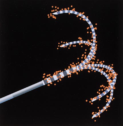RFA -  electrodo aguja de cuatro púas con calor alrededor de la punta.