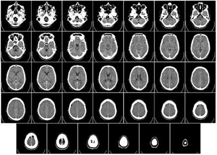 A series of images resulting from a CT scan.