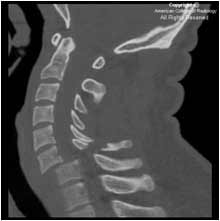 CT image