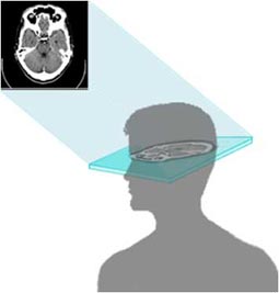 Illustration showing a head CT image.